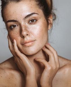 Skincare freckled woman