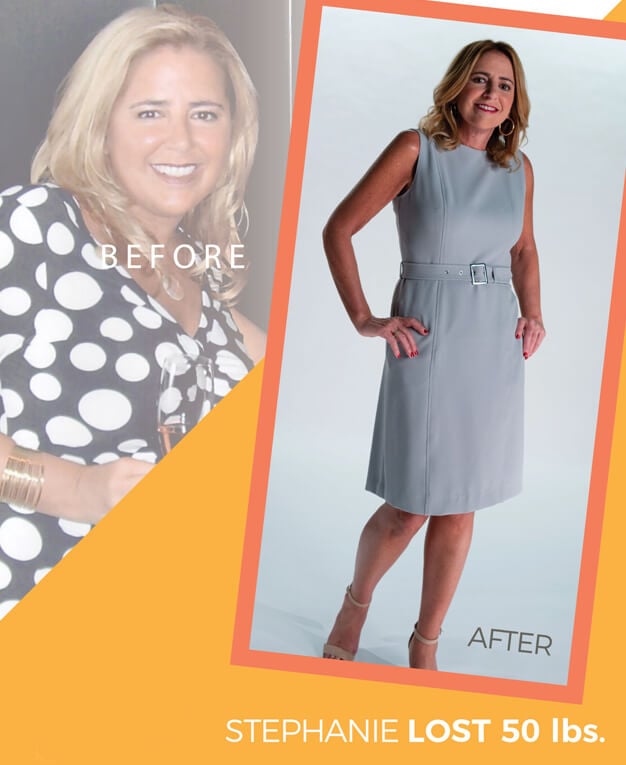 woman before and after her Orbera weight-loss balloon procedure