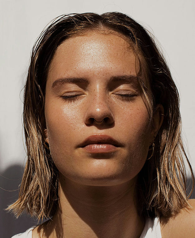 Woman after laser peel.