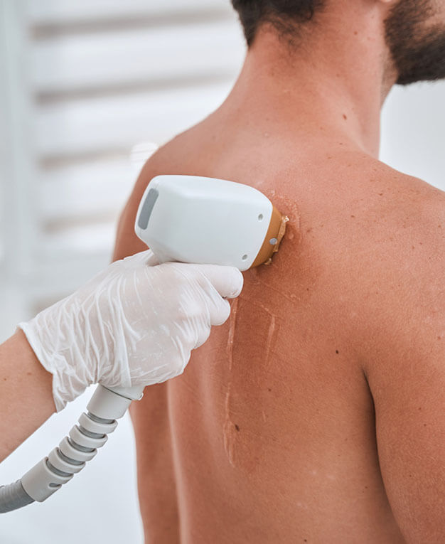 laser hair removal in Nashville and Memphis, TN
