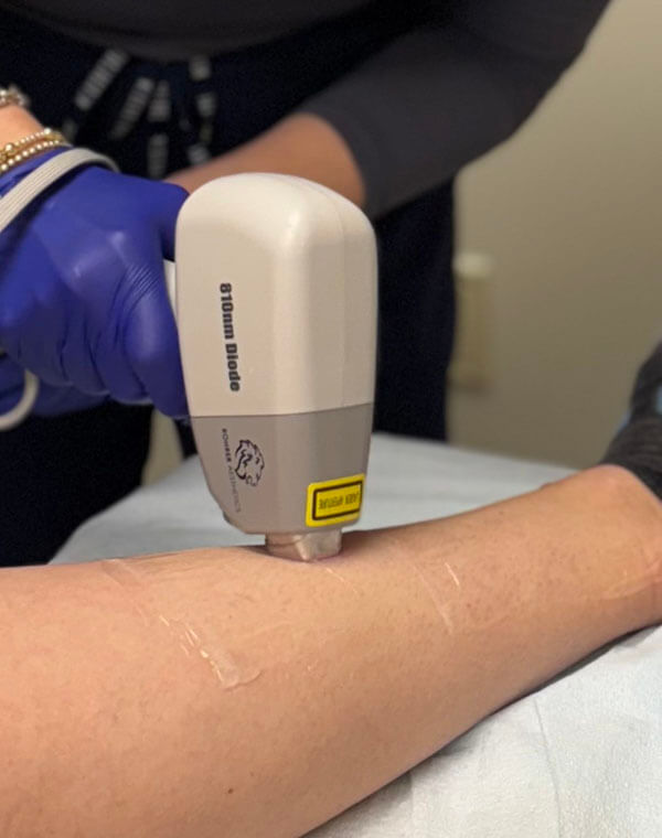 laser hair removal at nubody concepts cosmetic surgery & medspa Germantown